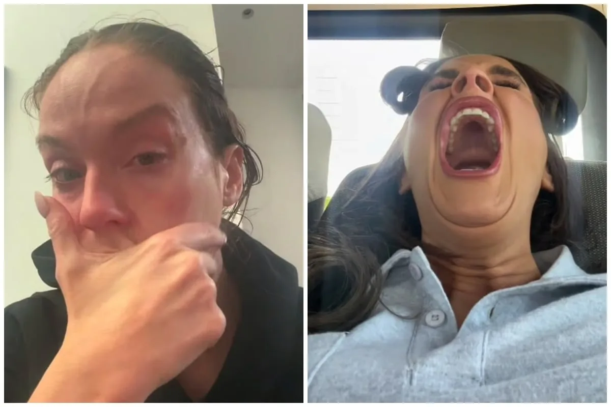 Vicky Pattison Says She Was 'Gaslit by Doctors' for Years Over PMDD
