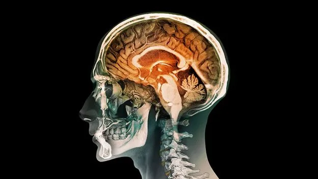 Woman Born Without Cerebellum Lives Normal Life