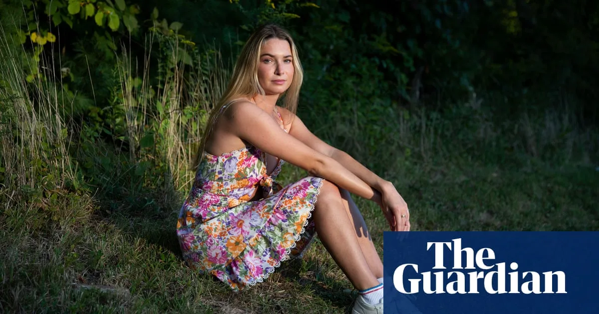 Woman's Rare Condition Leaves Her Allergic to Nearly Everything