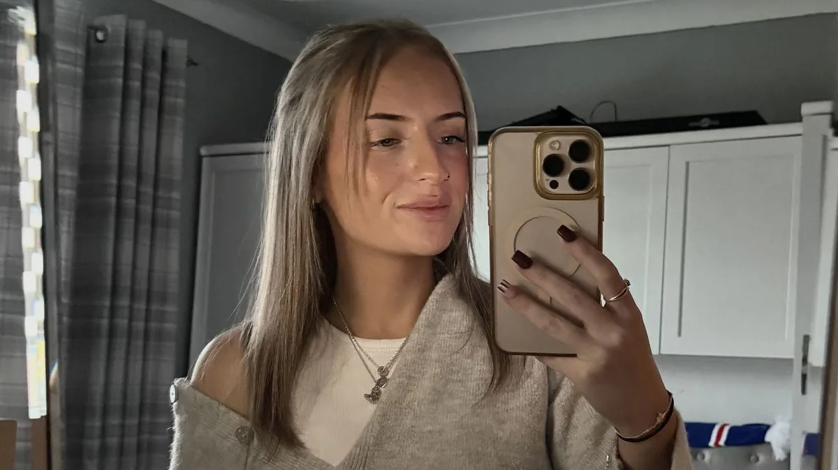 Woman's NHS Botox for Excessive Sweating Cut