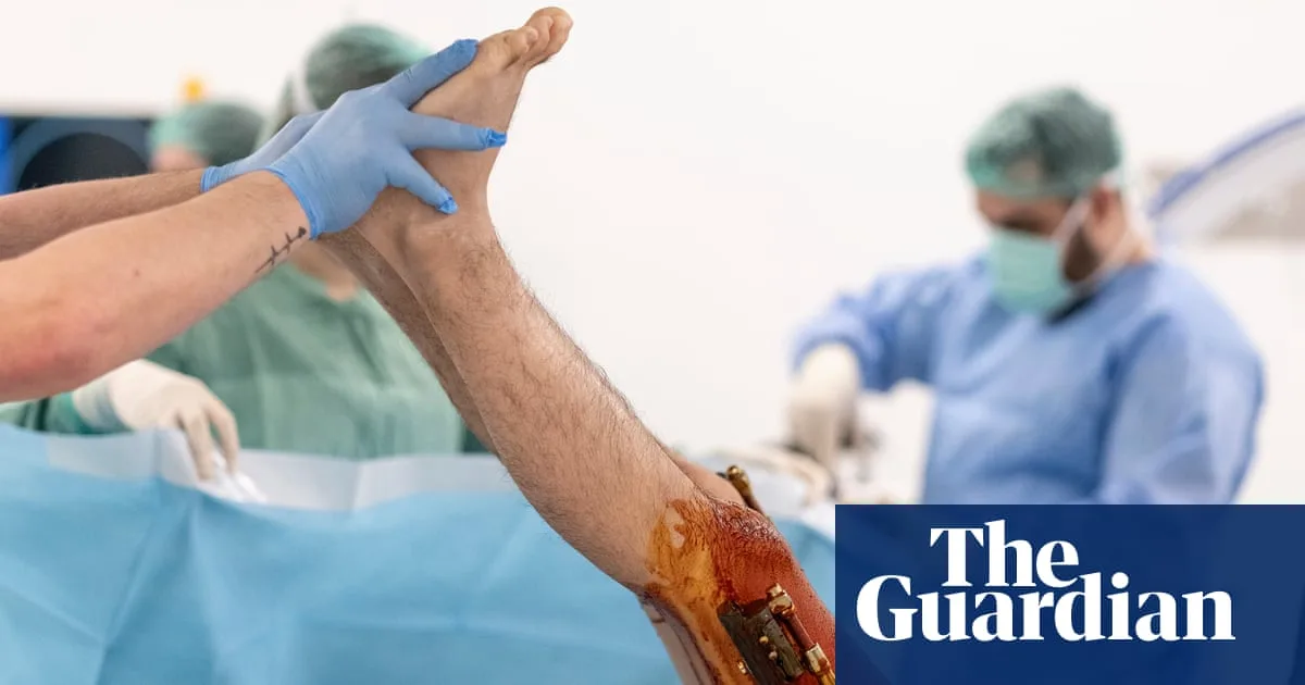 Men Paying Thousands for Leg Lengthening Surgery in Turkey