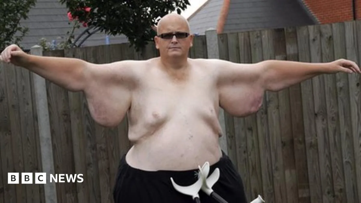 Former 'World's Fattest Man' Paul Mason Opens Up About Food Addiction