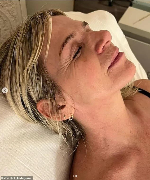Zoe Ball Reveals TMJ Battle After Announcing BBC Radio 2 Departure