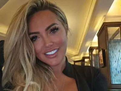 Big Brother's Aisleyne Horgan Wallace 'scarred for life' after XL Bully attack