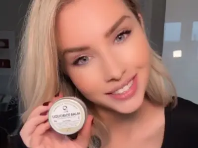 Cold Sore Sufferer Hails £10 Balm That Ended Outbreaks for 4 Years