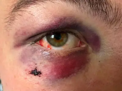 Teen beaten black and blue at TRNSMT by mob of youngsters