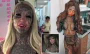 Australia's most tattooed woman flies to Spain for illegal body mods