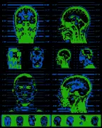 Brain Scans for Criminality: Controversial Science Used in US Courts