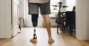 Brazil Man Amputates Foot to Fake Robbery for Insurance Payout