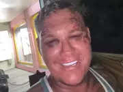British Tourist Drugged, Attacked, and Robbed of £1,800 in Bali