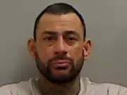 Brother's skull surgery after attack at mother's home in Stockton