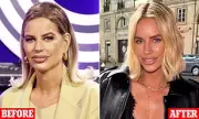 Caroline Stanbury Stuns Fans with Before and After Facelift Photos