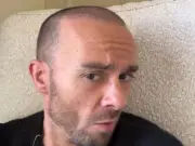 Coronation Street's David Platt to Wear Wig After Third Hair Transplant