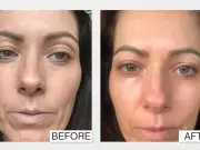 Dr Sebagh Anti-Ageing Serum Gets Rare 30% Discount for Amazon Prime Day