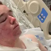 McDonald's worker suffers severe burns in hot oil attack by colleague