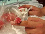 'Miracle' Twins Born 17 Weeks Early Survive Against All Odds After 225 Days in Hospital