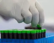 Mpox Smuggling Case Prompts Congressional Scrutiny of NIH