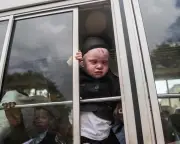 Nigerian with albinism deported under Trump asylum crackdown