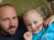 Parents told not to worry about son's rash; he had leukaemia