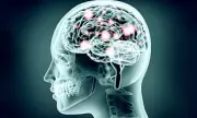 Spinal Cord Stimulation Boosts Arm Mobility in Stroke Survivors