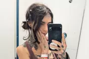 Student's 'Party Tricks' of Dislocating Joints Revealed as Rare Condition