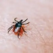 Tick Bite Could Cause Life-Threatening Meat Allergy, Experts Warn
