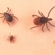 Ticks 'Rampant' in North Wales After Heatwave: Expert Advice