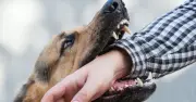 Vet names 3 dog breeds most likely to bite: not pit bulls or Rottweilers