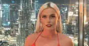 Woman, 26, Collapses Without Warning From Brain AVM, Warns Others