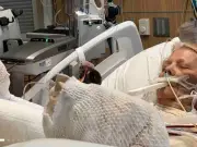 Woman, 82, Fighting for Life After Severe Sunburn and Metal Chair Burns