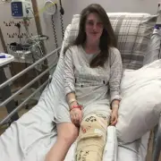 Woman's Dull Knee Ache Turned Out to Be Rare One-in-a-Million Disease