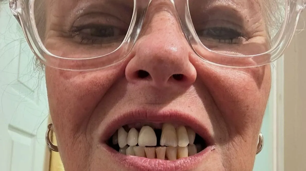Mum's £12,000 dental transformation ends years of soup diet