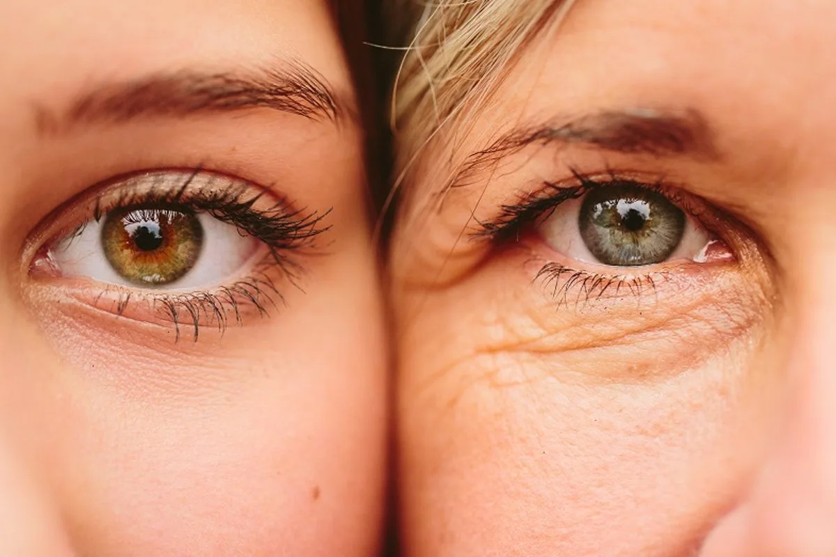 Astigmatism: The Common Eye Condition Affecting 40% of People Explained