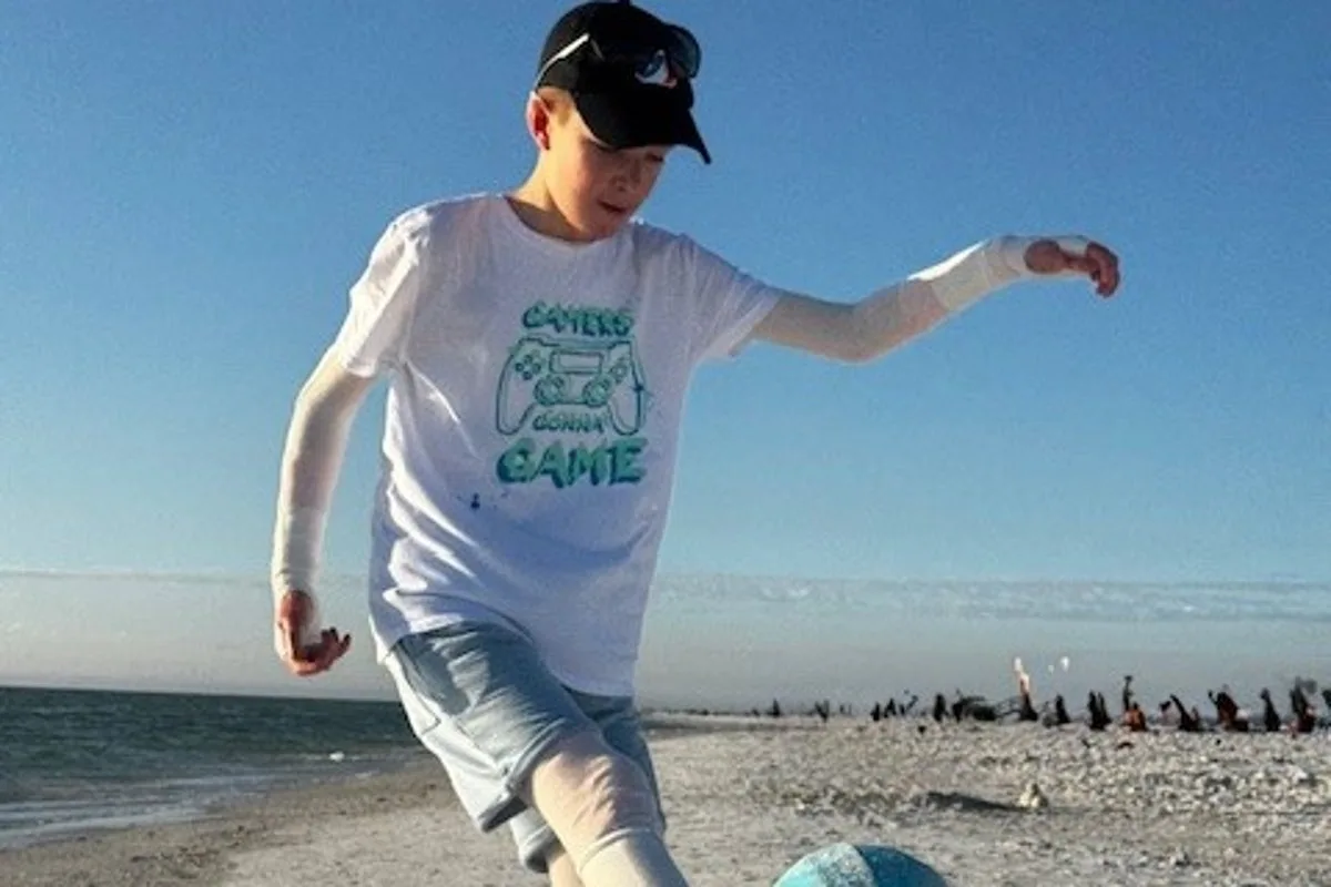 Boy, 12, with rare skin condition gains freedom after breakthrough trial