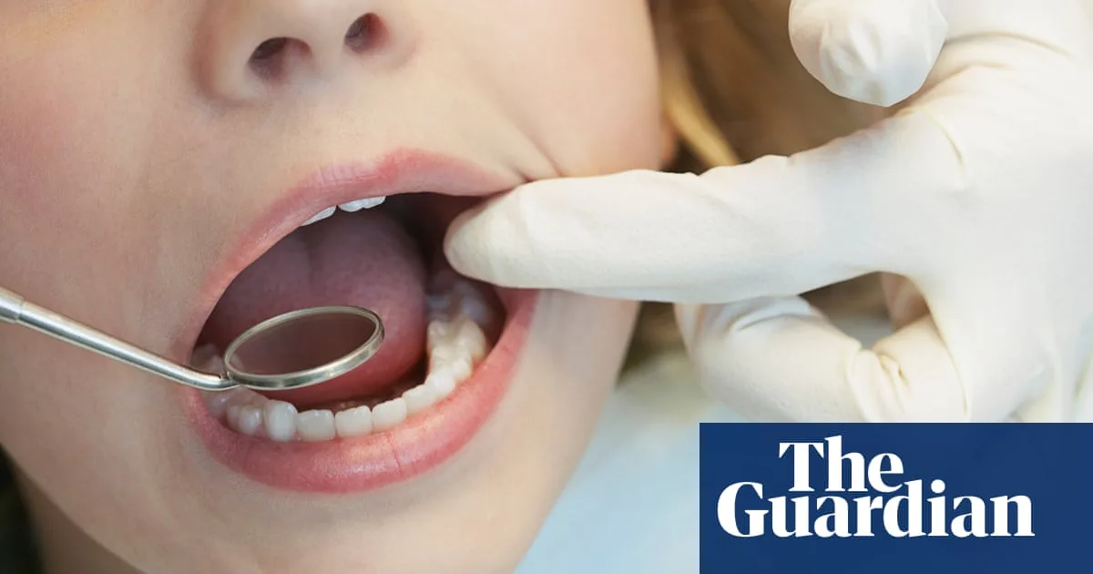 Water fluoridation cuts tooth decay in Queensland children, study finds