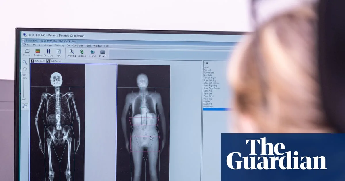 Full-Body Scans of 100,000 People Could Transform Disease Detection, UK Biobank Study Finds