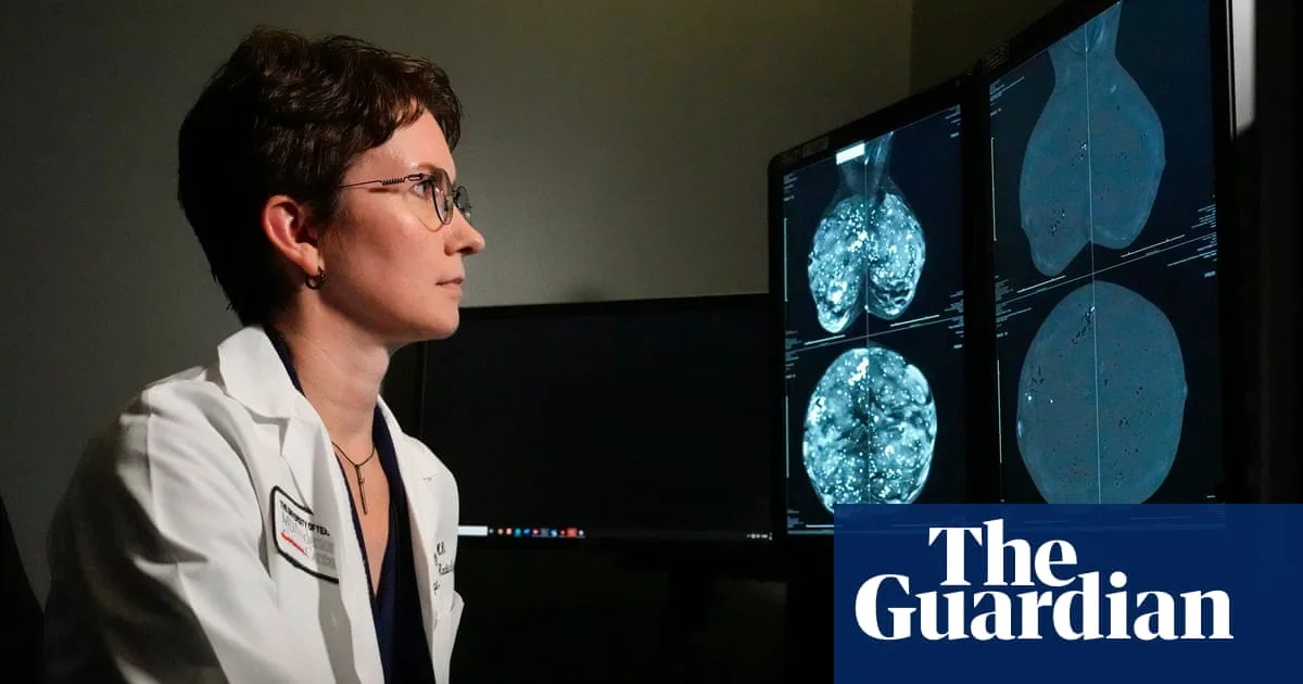 Genomic test could spare millions of breast cancer patients chemotherapy
