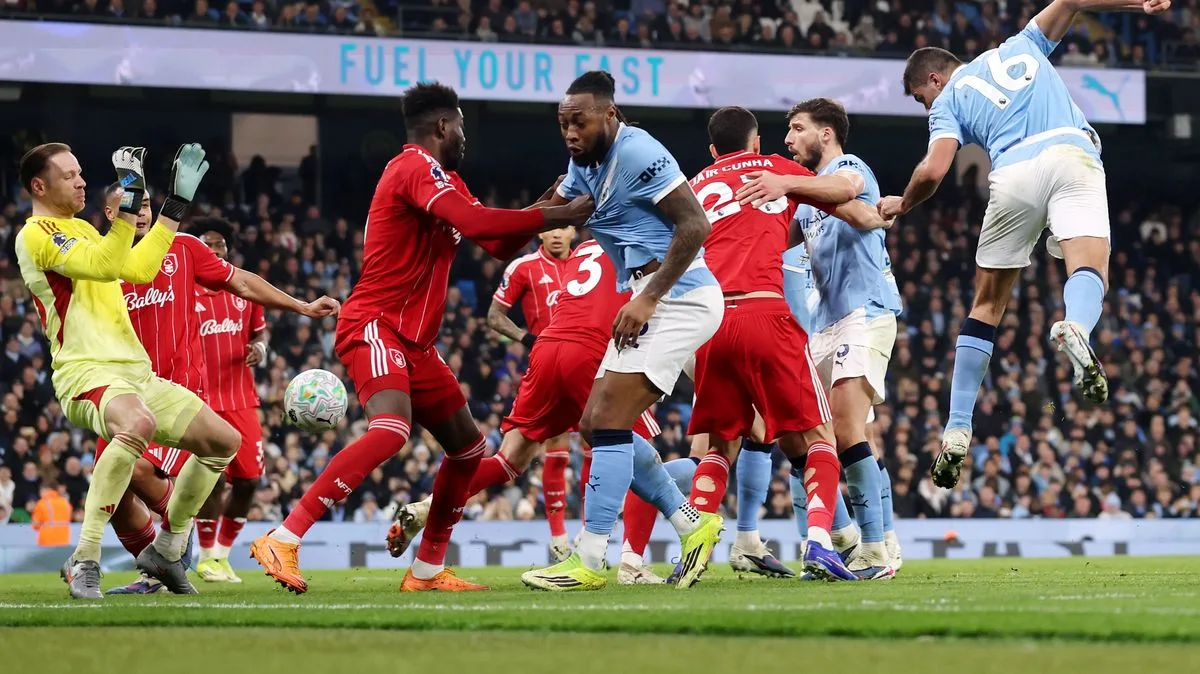 Guardiola Defends Man City After Costly Forest Draw