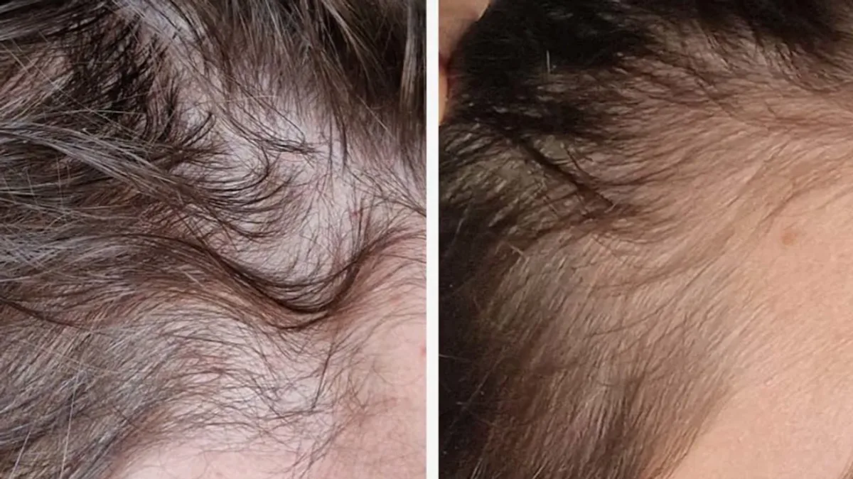 Hair 'growing like crazy' with 56p-a-day supplement used by Sara Cox