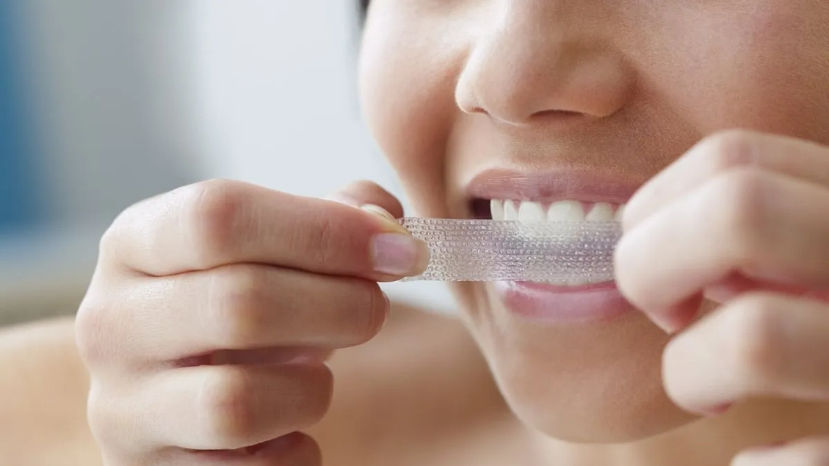 Illegal Teeth Whitening Strips Burn Gums: UK Warning