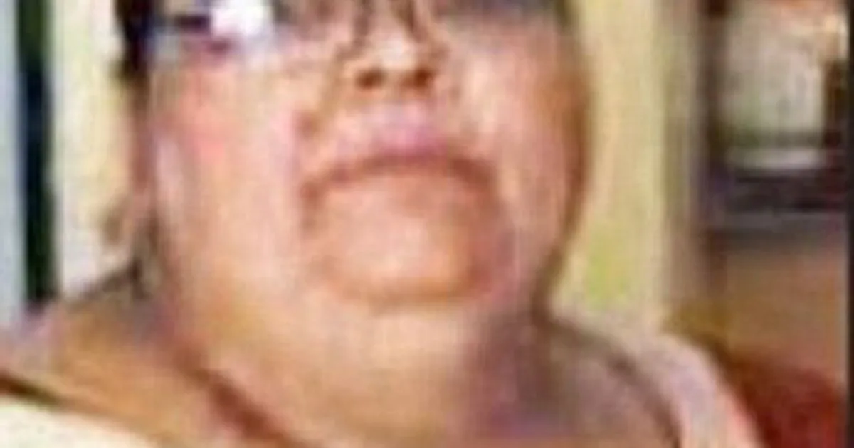 Couple Dies in Freak Accident as Overweight Woman Falls on Husband