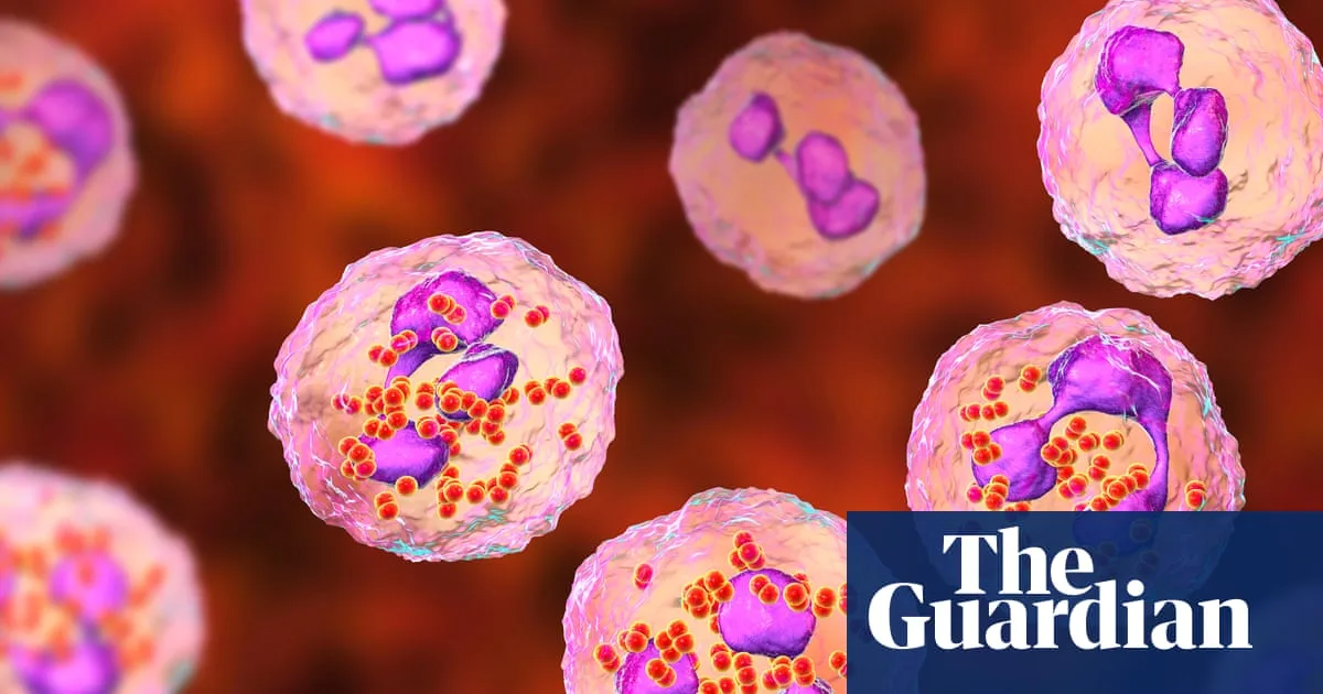 Meningitis B Vaccine Review Underway After Kent Outbreak