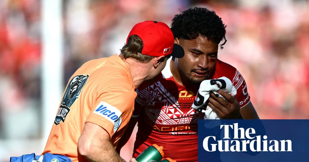Eli Katoa's Career in Doubt After Brain Surgery