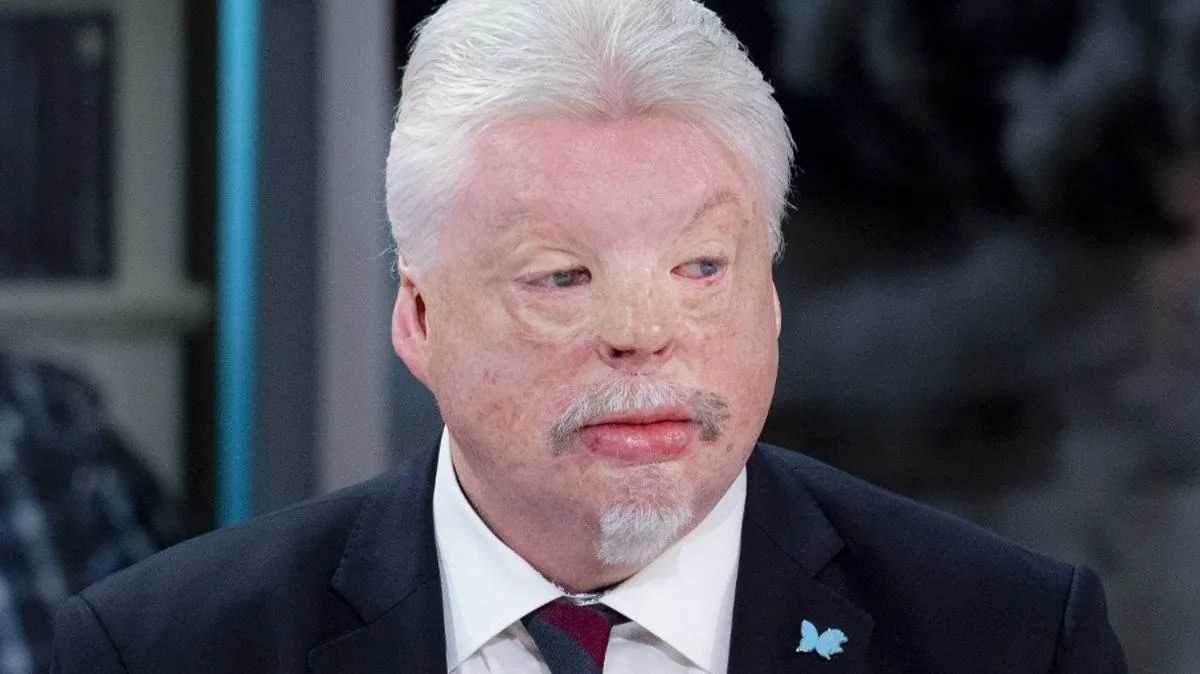 Falklands Hero Simon Weston Slams Trump's 'Hissy Fit' Over Islands