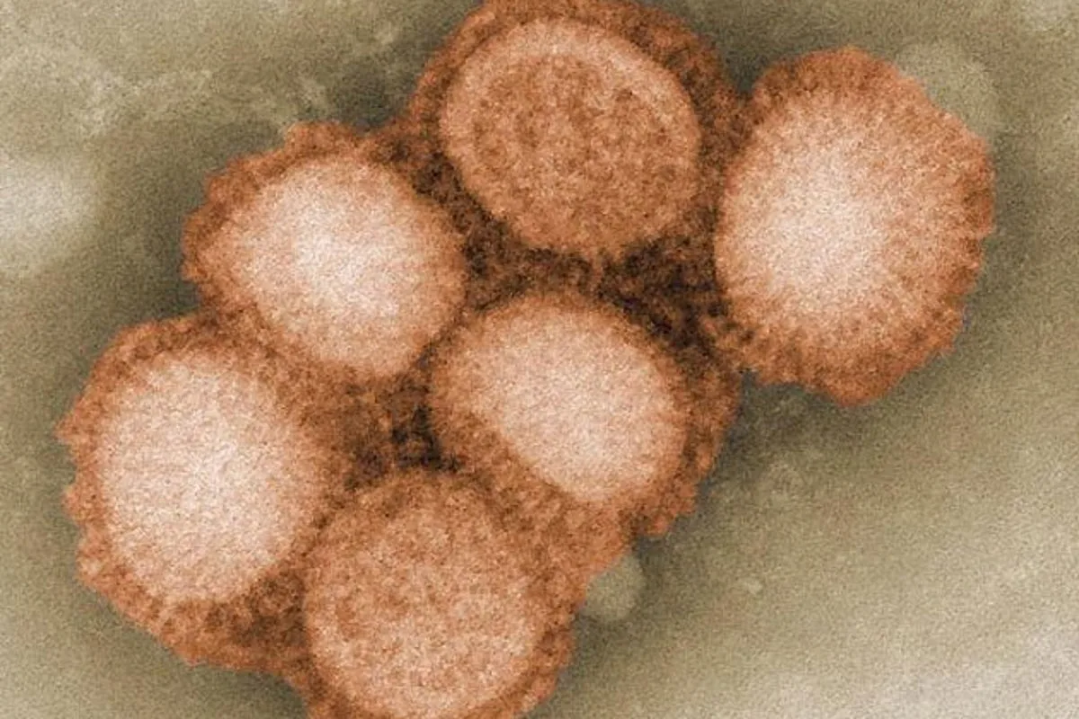 Spain Reports Suspected Human-to-Human Transmission of Swine Flu