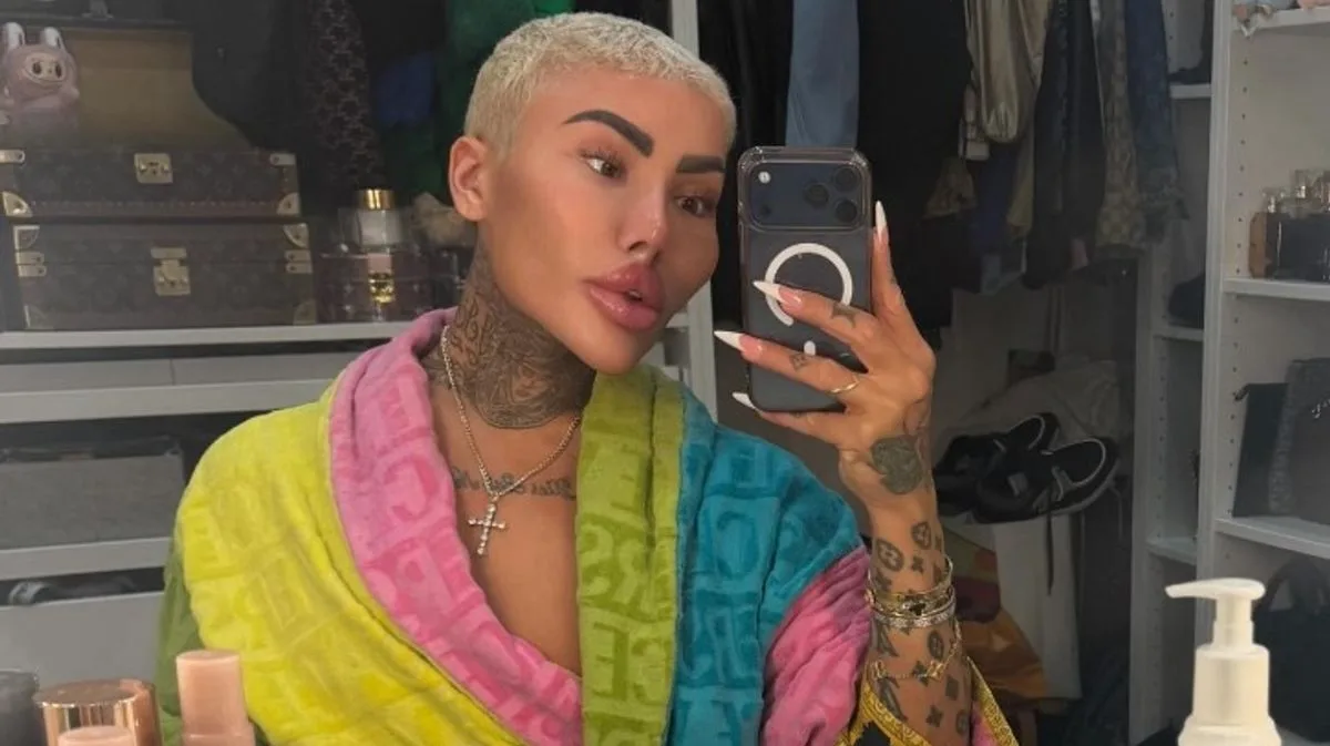 Two Arrested After Kim Kardashian Lookalike 'Lip King' Dies