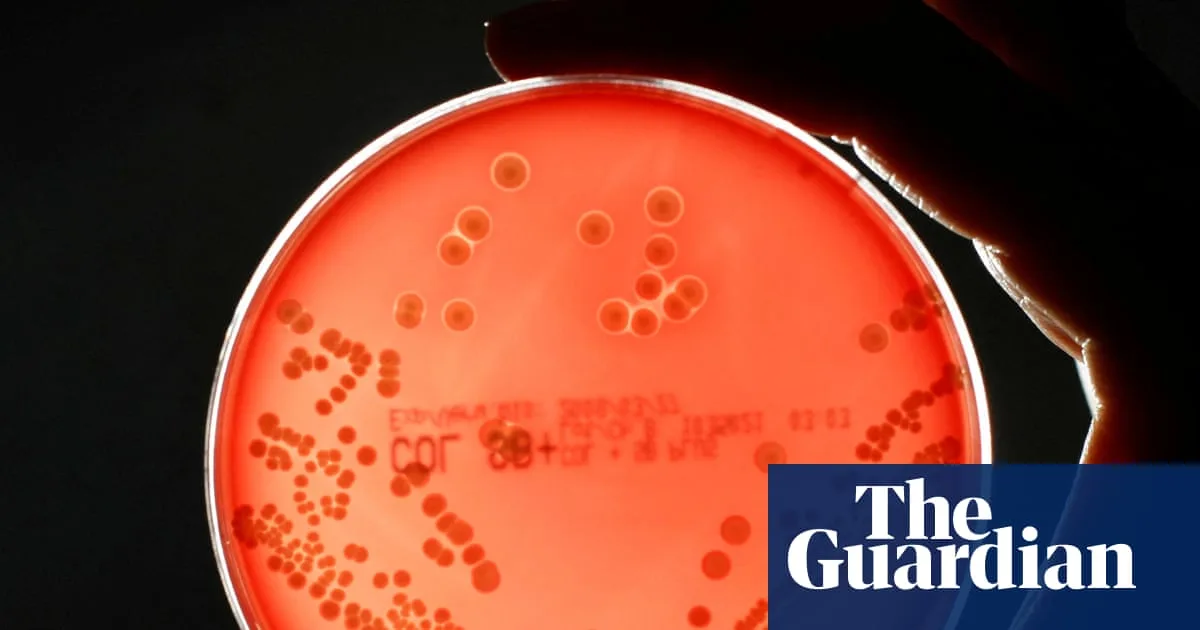Antibiotic-Resistant Superbug Deaths Rise 17% in England