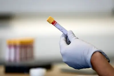 Blood Test Could Detect Sjogren's Disease 10 Years Before Symptoms