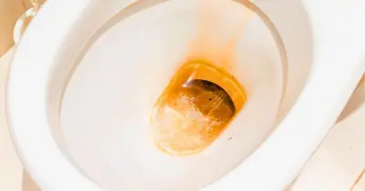 Ditch bleach for citric acid to keep toilets limescale-free