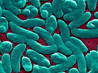 Explosive Diarrhea Parasite Cyclospora Spreads Globally: Full List of Affected Locations